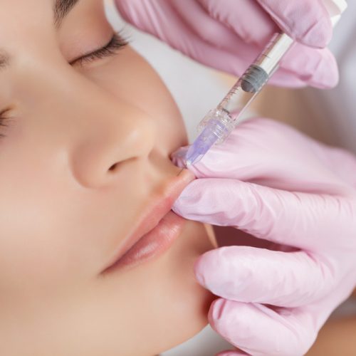 The,Doctor,Cosmetologist,Makes,Lip,Augmentation,Procedure,Of,A,Beautiful