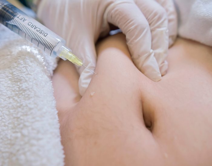 Closeup,Of,A,Lipotropic,Injection,Into,The,Subcutaneous,Fat,Below
