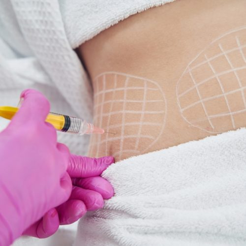 Dermatologist,Performing,Non,Invasive,Fat,Reduction,Procedure,In,Beauty,Center